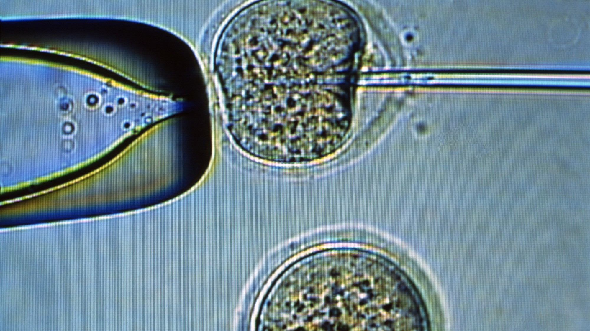 First successful cloning of human stem cells